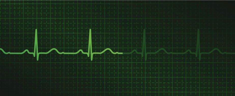 heart monitor