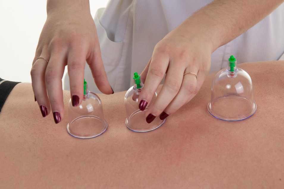 Cupping Therapy NYC Safe Places