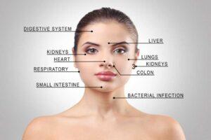 Ayurvedic Face Mapping For Acne