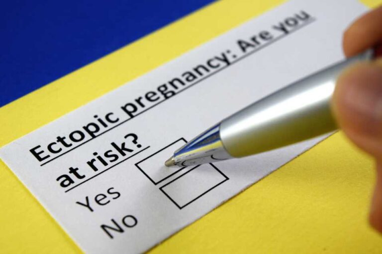 Everything You Wonder About Ectopic Pregnancy