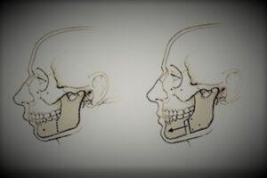 Benefits Of Oral Facial Surgery