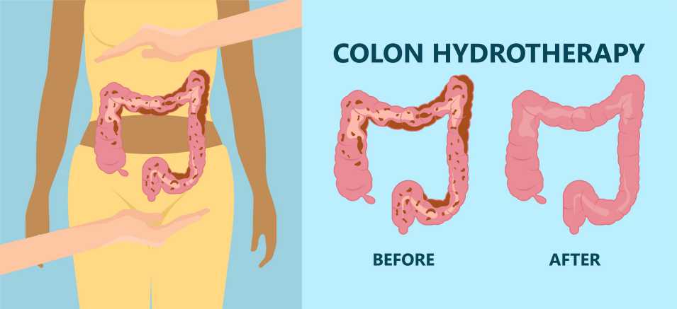 Colonic Therapy in NYC: What You Need to Know Before Your First Appointment
