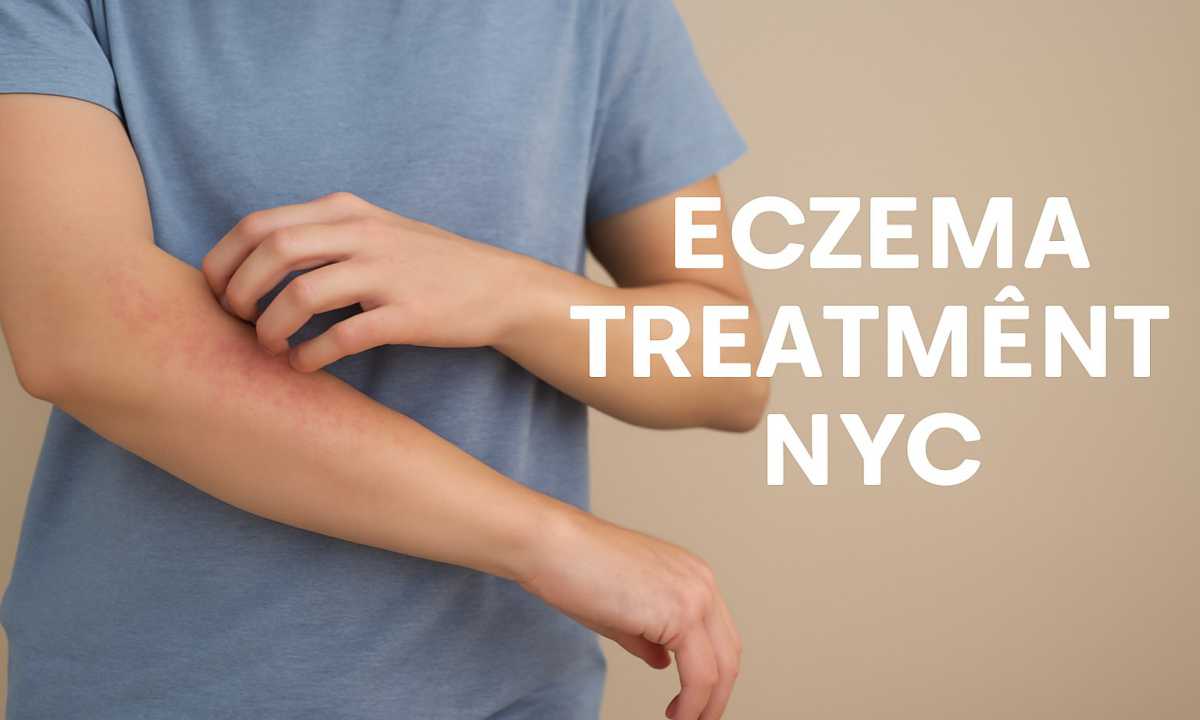 Eczema Treatment NYC: